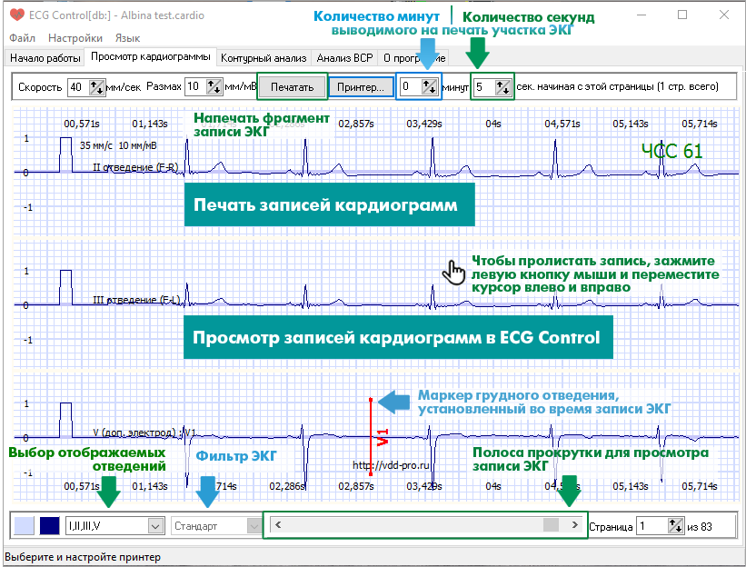 Просмотр кардиограмм и печать записей ЭКГ - руководство ECG Control v.4