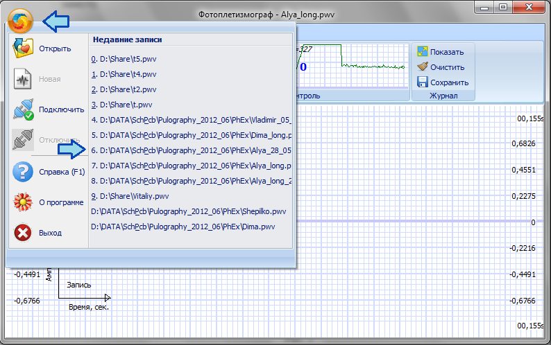 Компьютерный фотоплетизмограф — Моя автоматика