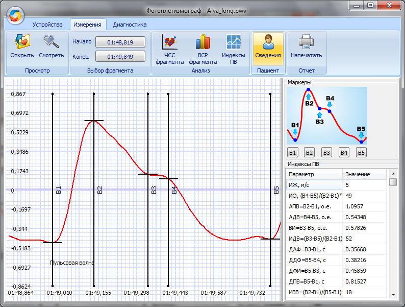 Компьютерный фотоплетизмограф — Моя автоматика