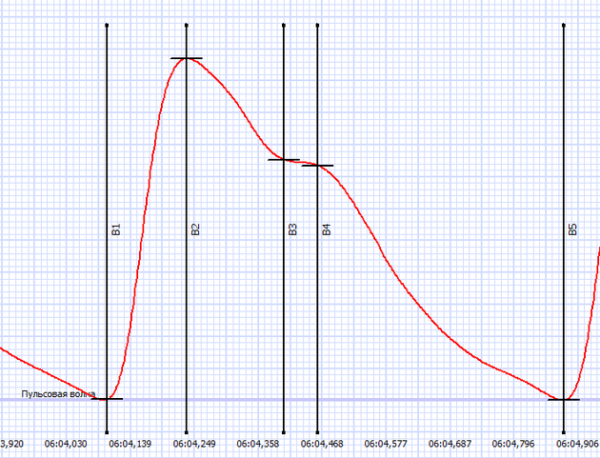 Зачем нужен фотоплетизмограф, и что такое контурный анализ… — Моя ...